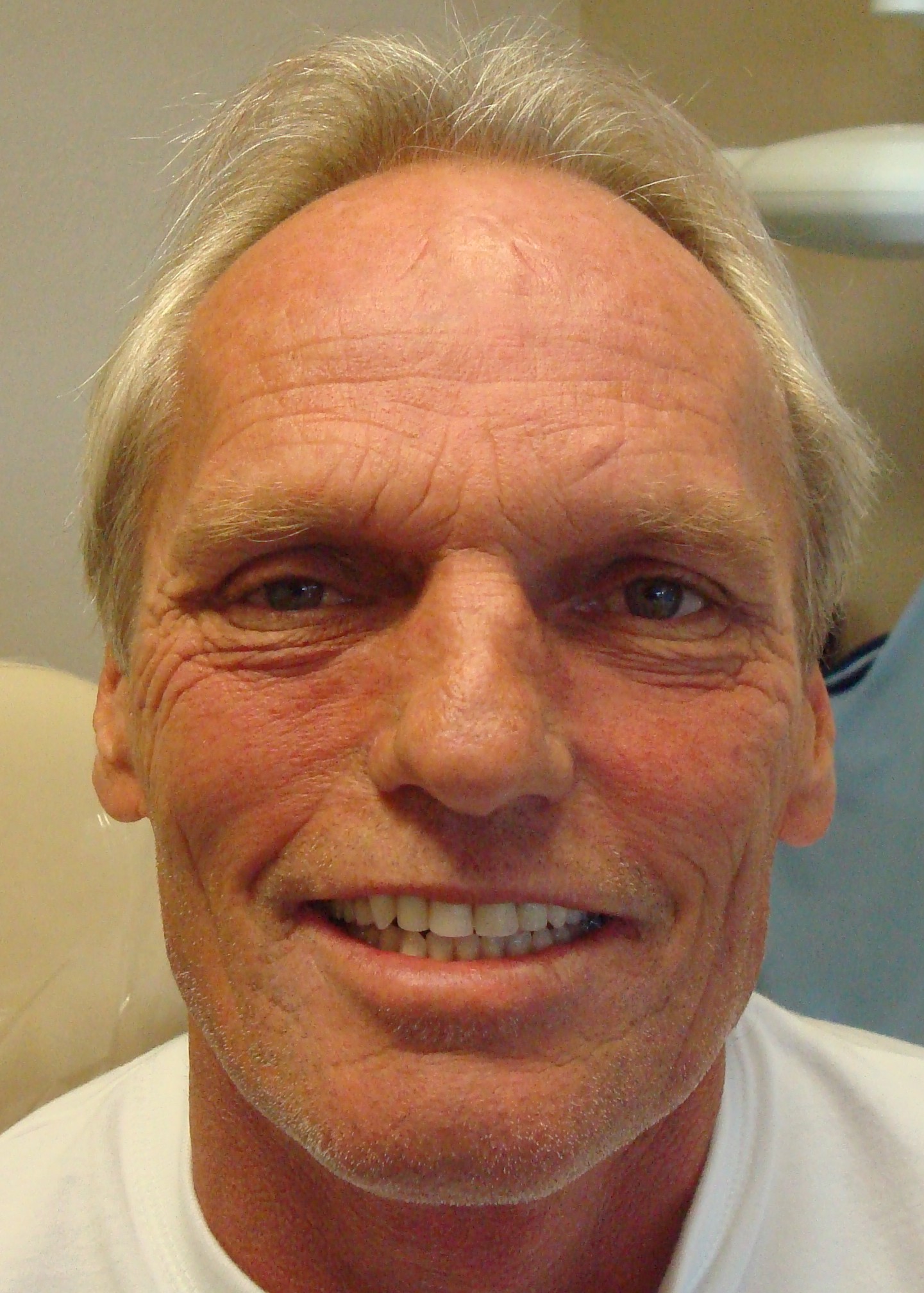 Smile Gallery Fair Oaks, CA Dr. Brian Orcutt